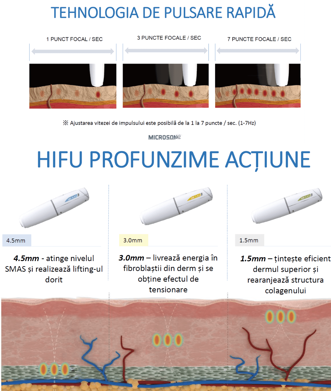 HIFU Derma View (2)